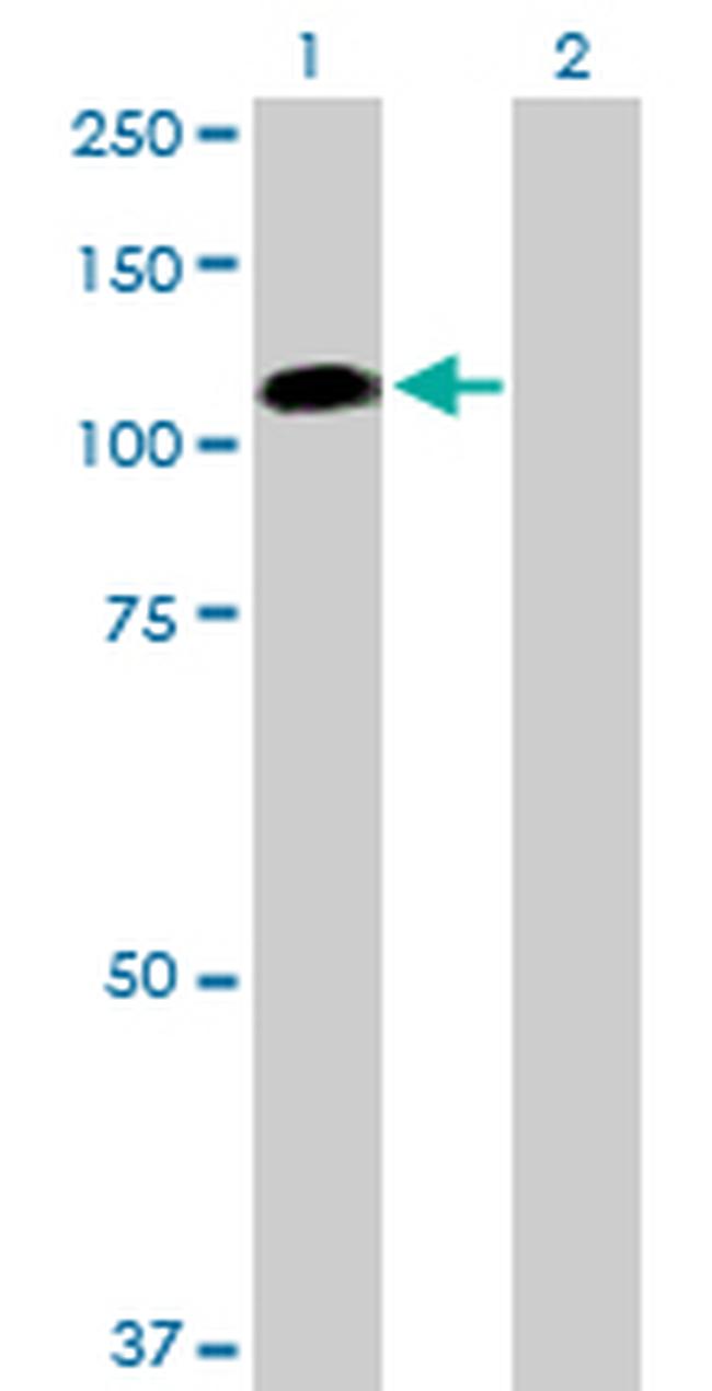 FAP Antibody in Western Blot (WB)