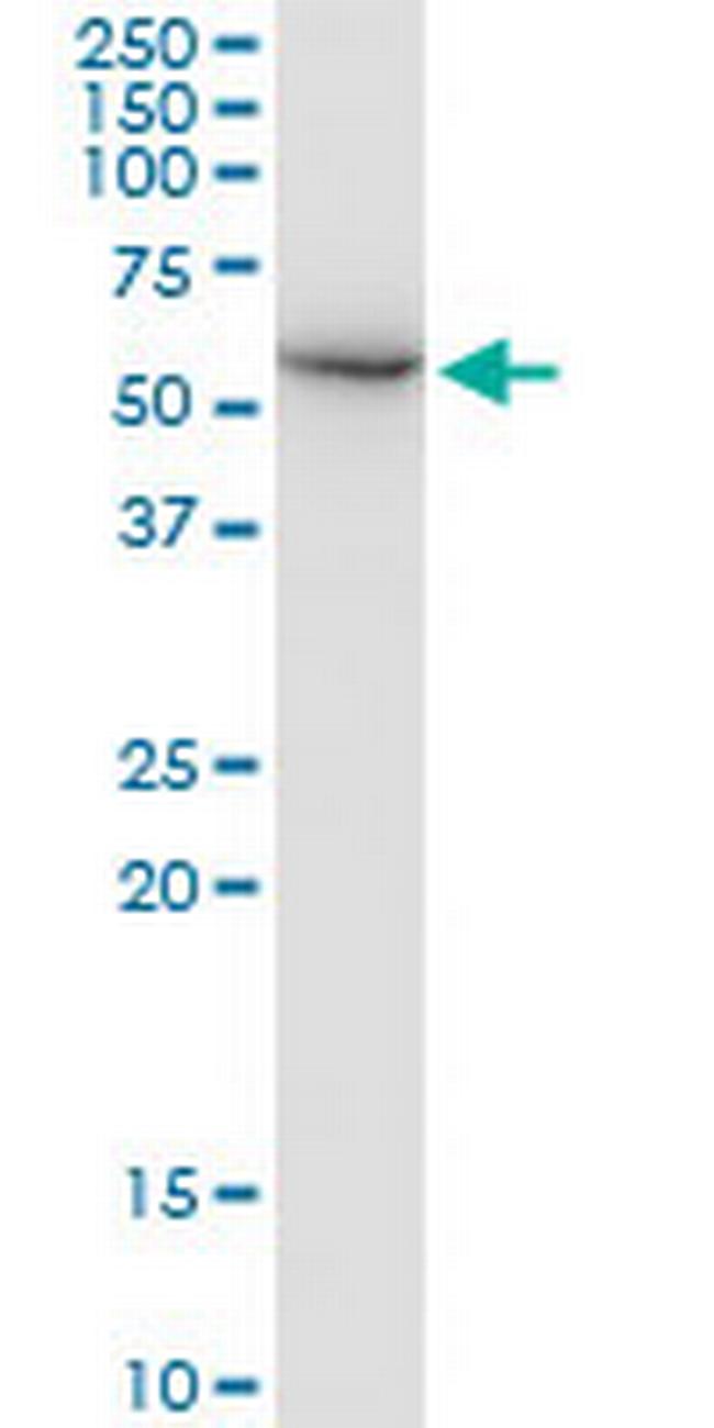 FARSA Antibody in Western Blot (WB)