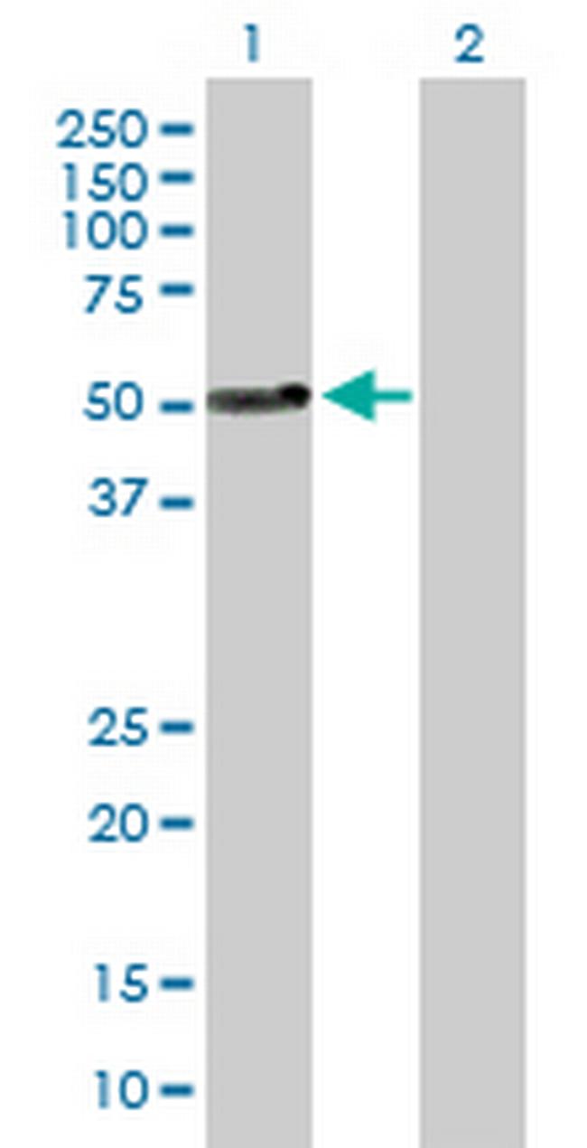 FASN Antibody in Western Blot (WB)