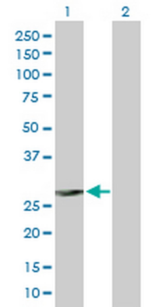 FCER1A Antibody in Western Blot (WB)