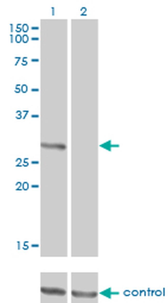 FCER1A Antibody in Western Blot (WB)