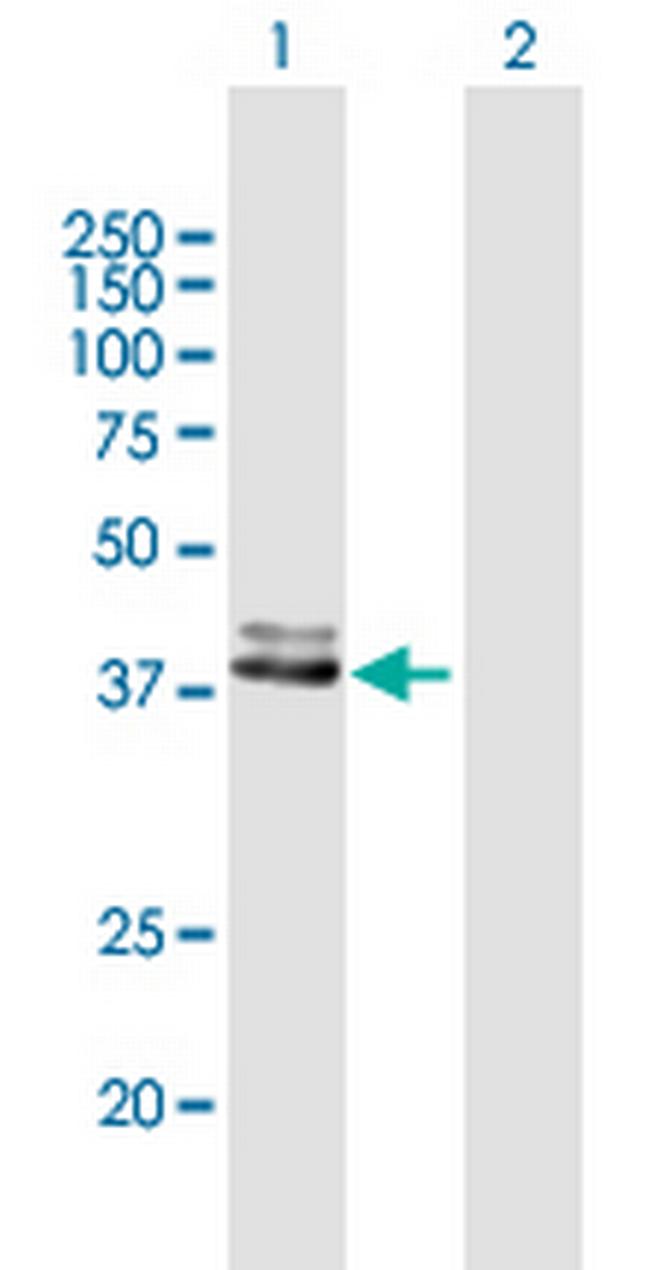 FECH Antibody in Western Blot (WB)