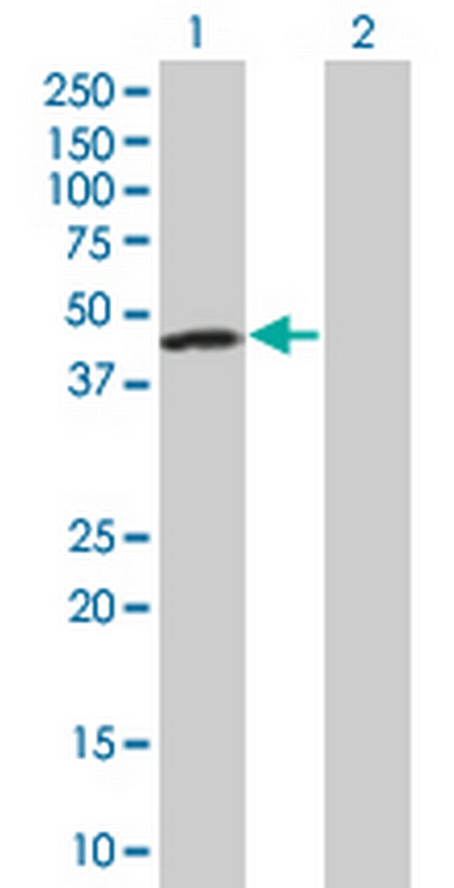 FEN1 Antibody in Western Blot (WB)