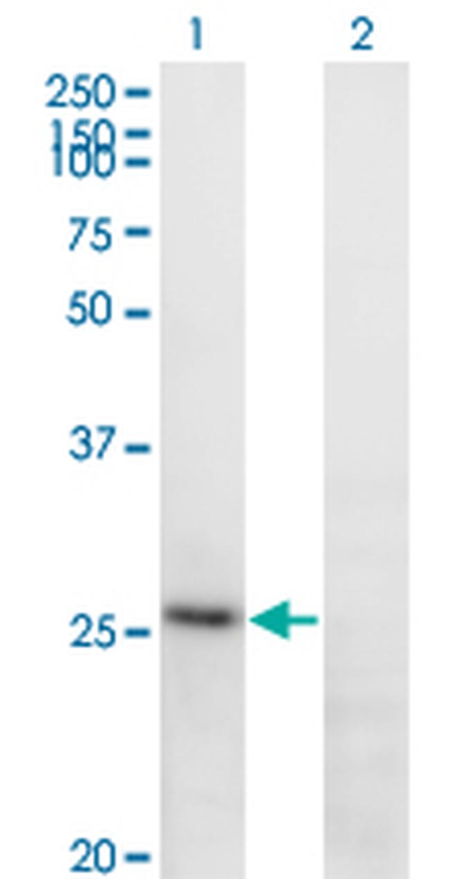 FGA Antibody in Western Blot (WB)