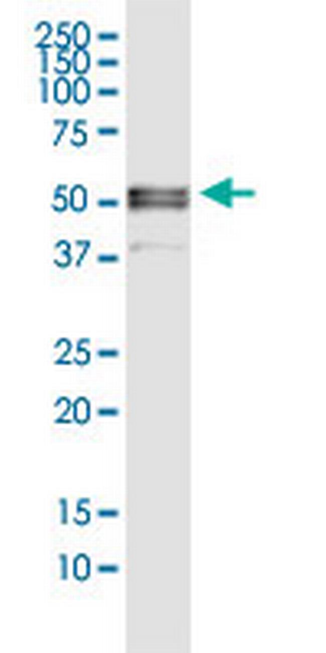 FGB Antibody in Western Blot (WB)