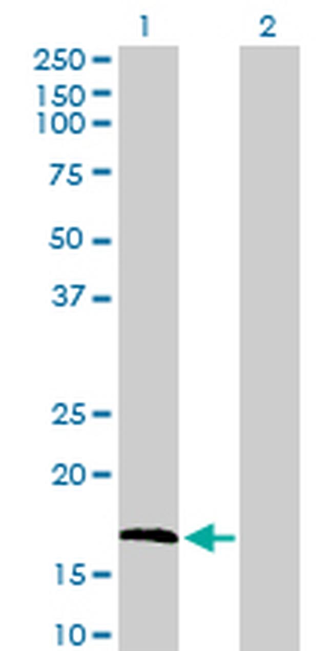 FGF1 Antibody in Western Blot (WB)