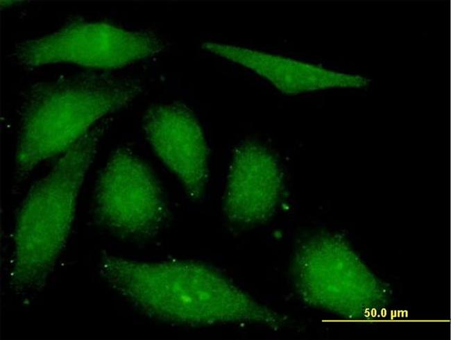 FGF1 Antibody in Immunocytochemistry (ICC/IF)