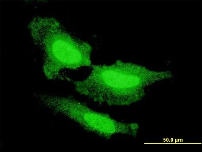 FGF1 Antibody in Immunocytochemistry (ICC/IF)