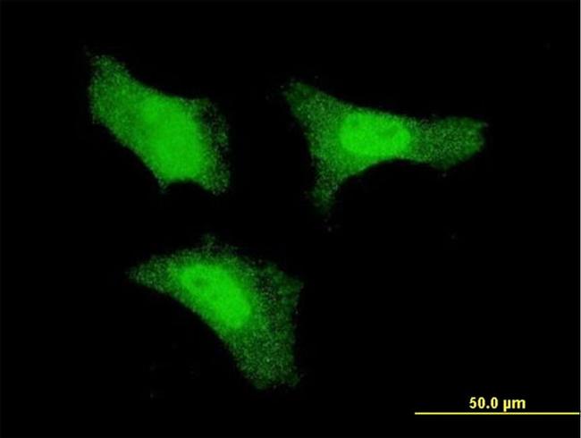 FGF1 Antibody in Immunocytochemistry (ICC/IF)