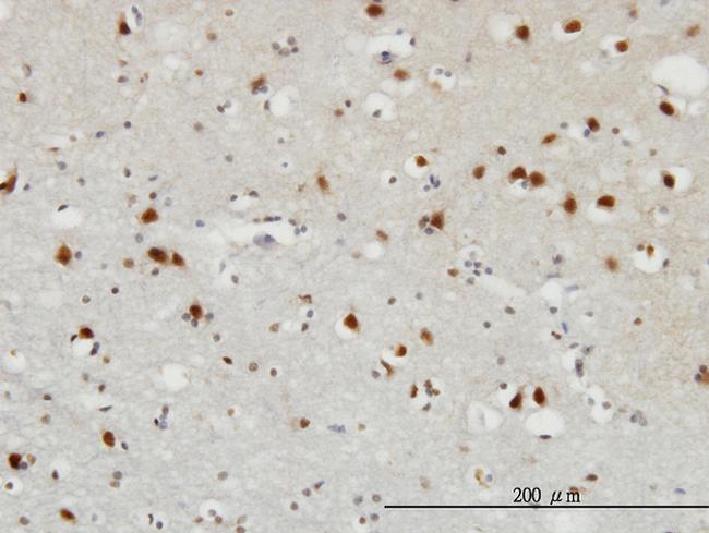 FGF12 Antibody in Immunohistochemistry (Paraffin) (IHC (P))