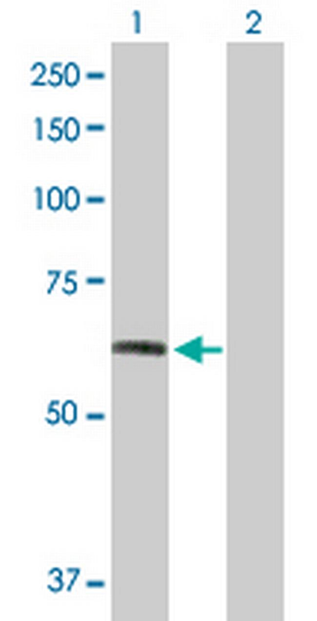 FGFR1 Antibody in Western Blot (WB)