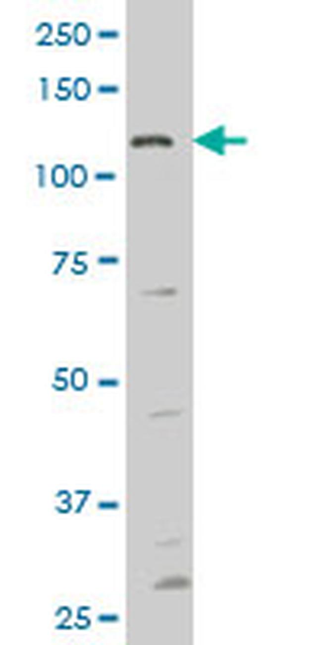 FGFR1 Antibody in Western Blot (WB)