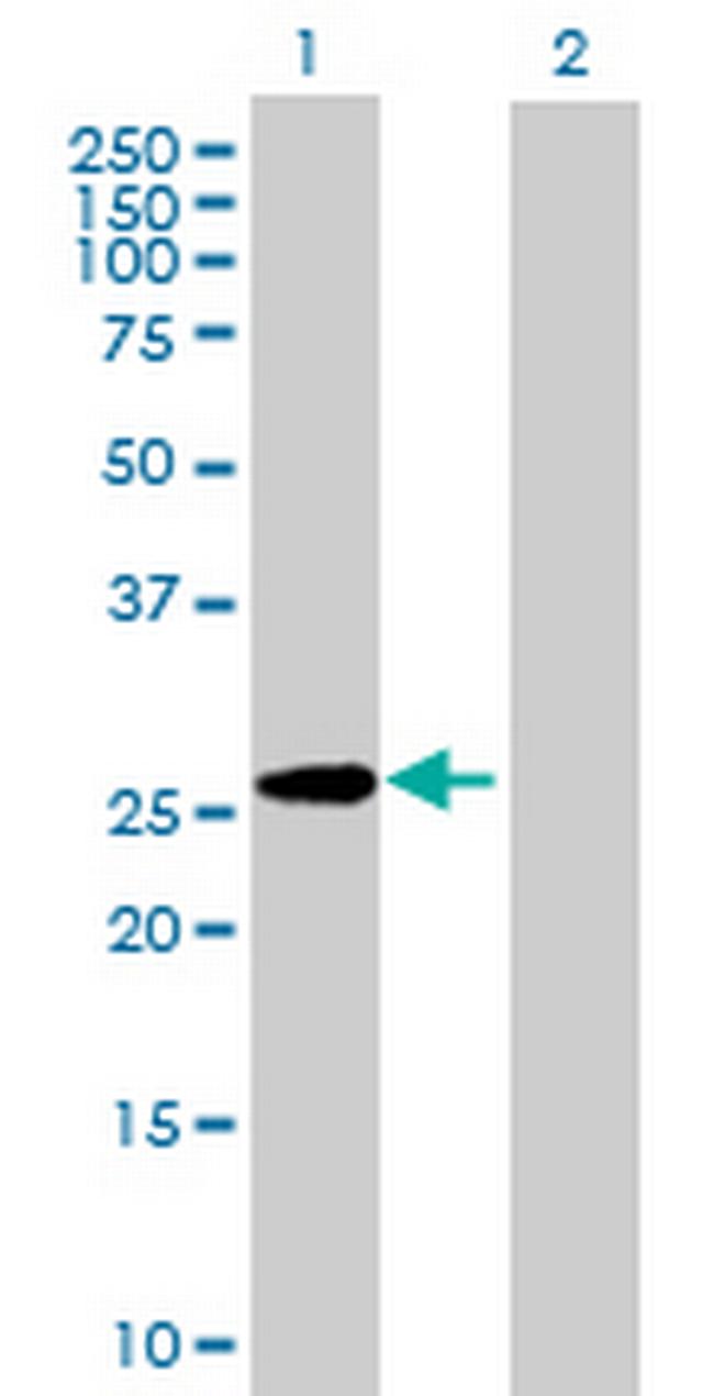 GPC5 Antibody in Western Blot (WB)