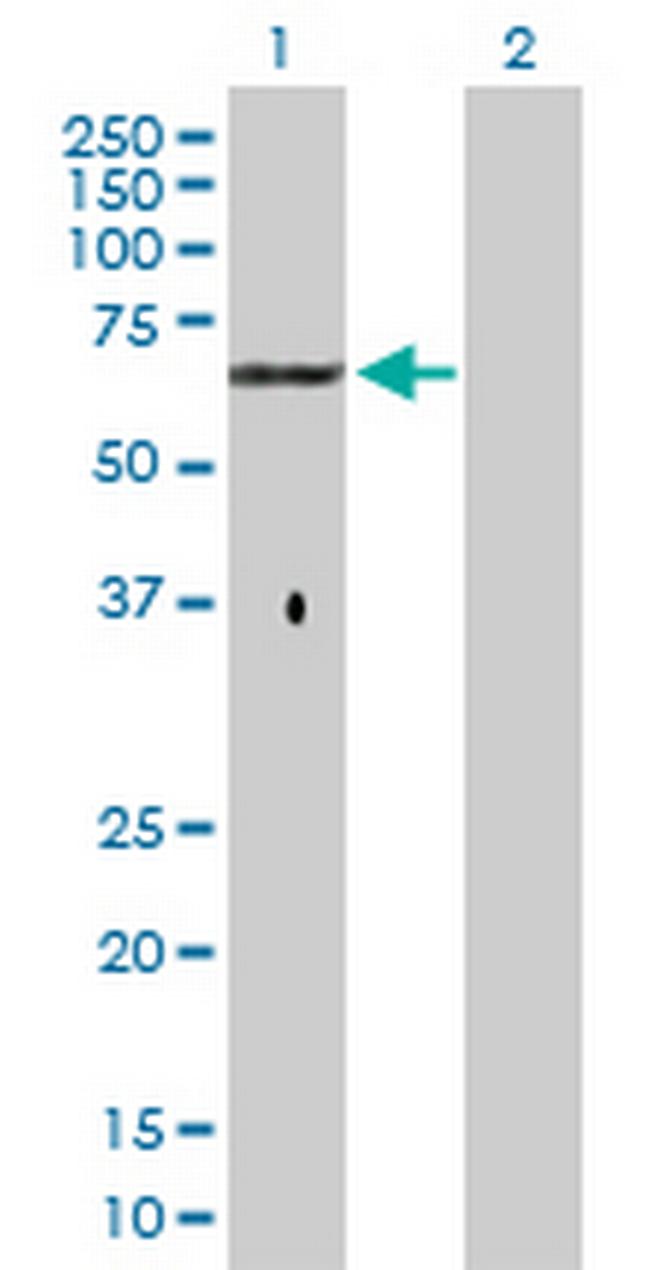 GPC5 Antibody in Western Blot (WB)