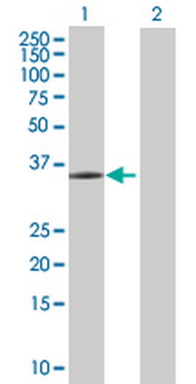 FGL1 Antibody in Western Blot (WB)