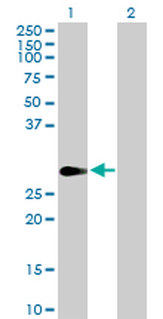 FHL1 Antibody in Western Blot (WB)