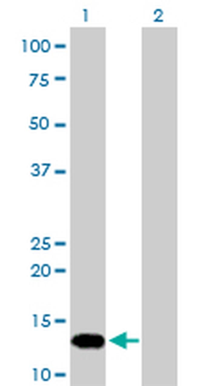 FKBP1A Antibody in Western Blot (WB)