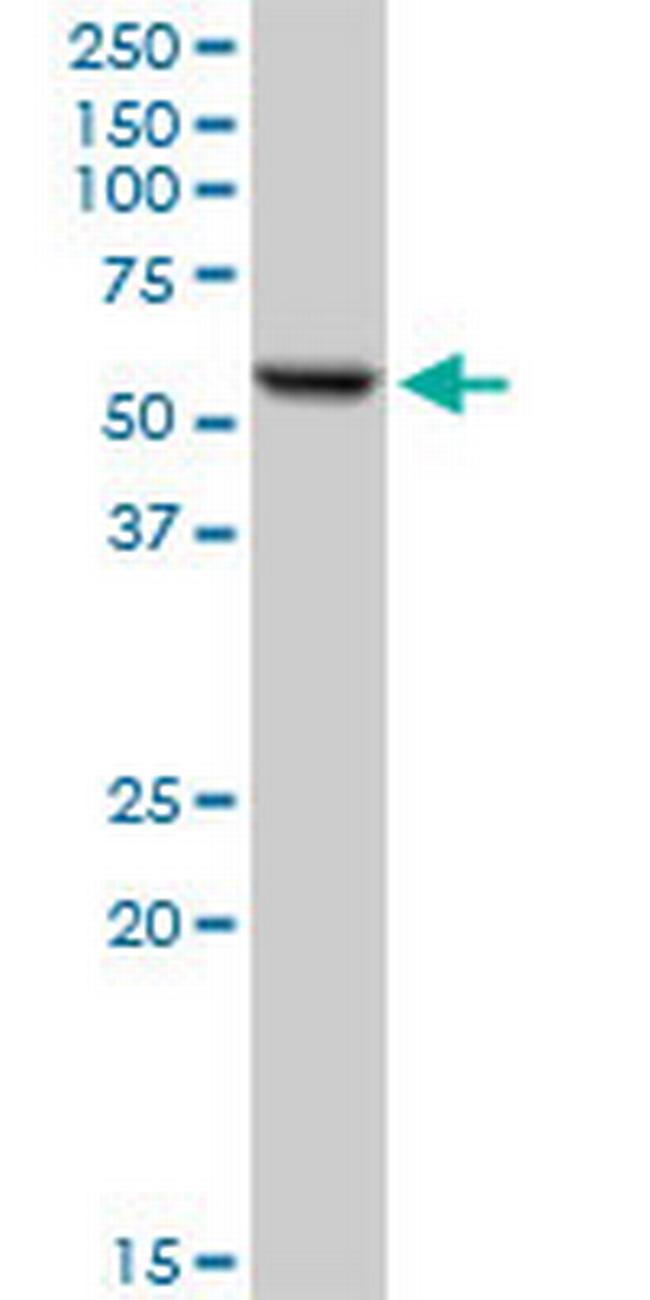 FKBP4 Antibody in Western Blot (WB)