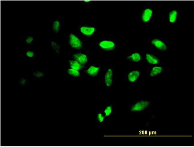 FOXF2 Antibody in Immunocytochemistry (ICC/IF)