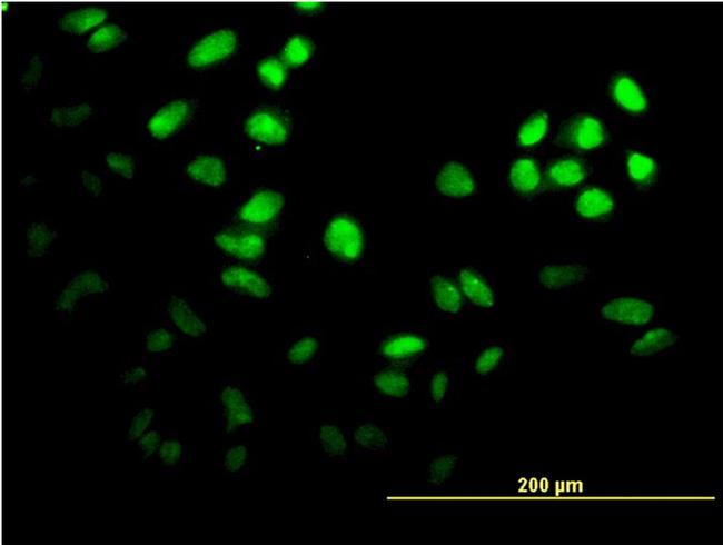 FOXF2 Antibody in Immunocytochemistry (ICC/IF)