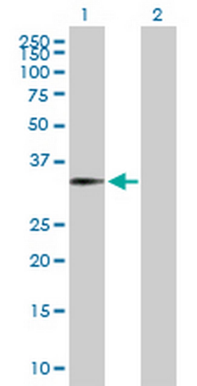 FOXJ1 Antibody in Western Blot (WB)