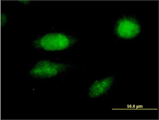 FOXC2 Antibody in Immunocytochemistry (ICC/IF)