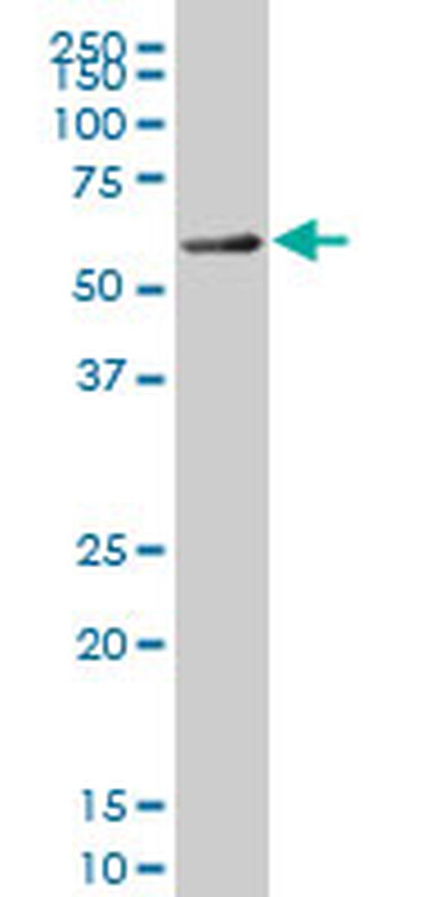 FOXC2 Antibody in Western Blot (WB)