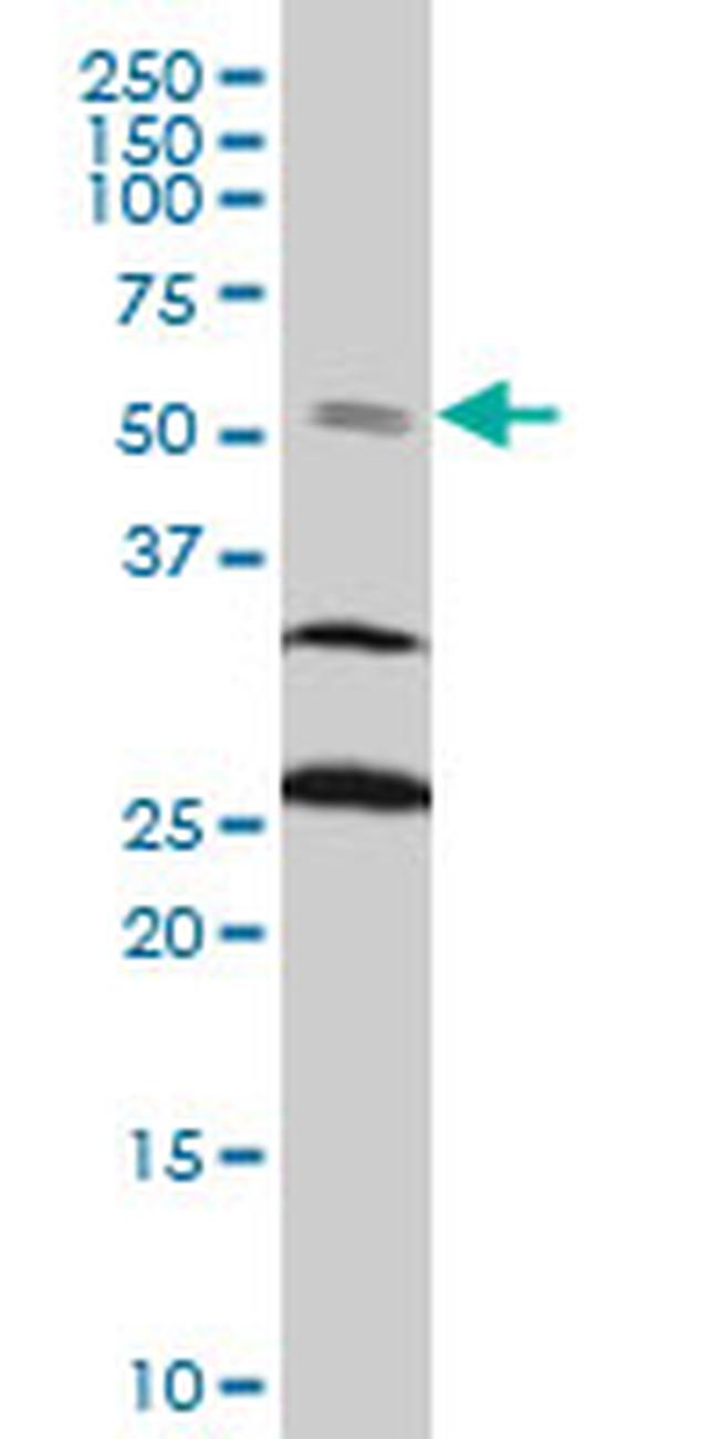 FOXC2 Antibody in Western Blot (WB)