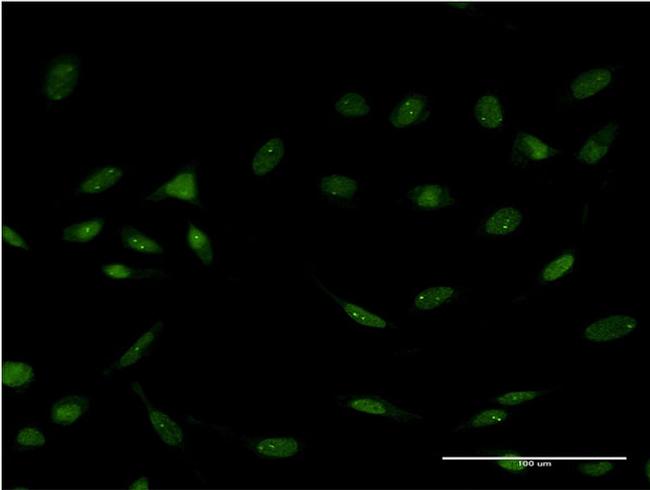 FOXC2 Antibody in Immunocytochemistry (ICC/IF)