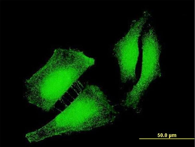 FOXO3A Antibody in Immunocytochemistry (ICC/IF)