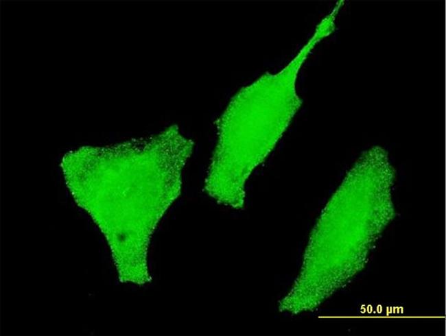 FOXO3A Antibody in Immunocytochemistry (ICC/IF)