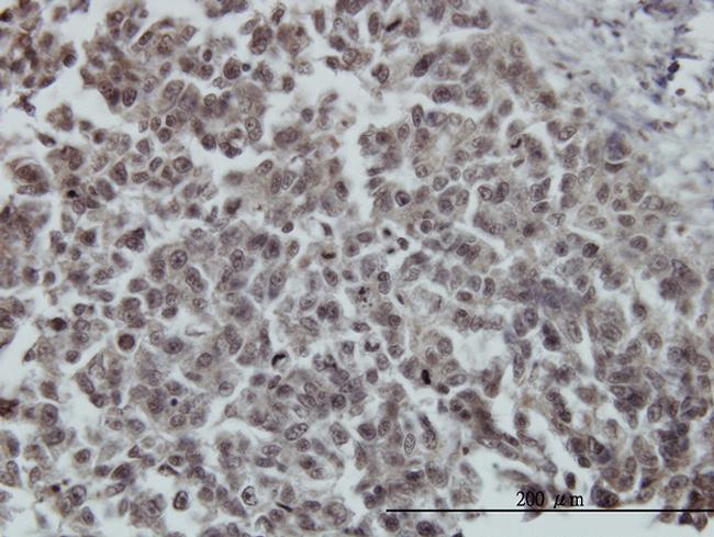 FOXO3A Antibody in Immunohistochemistry (Paraffin) (IHC (P))