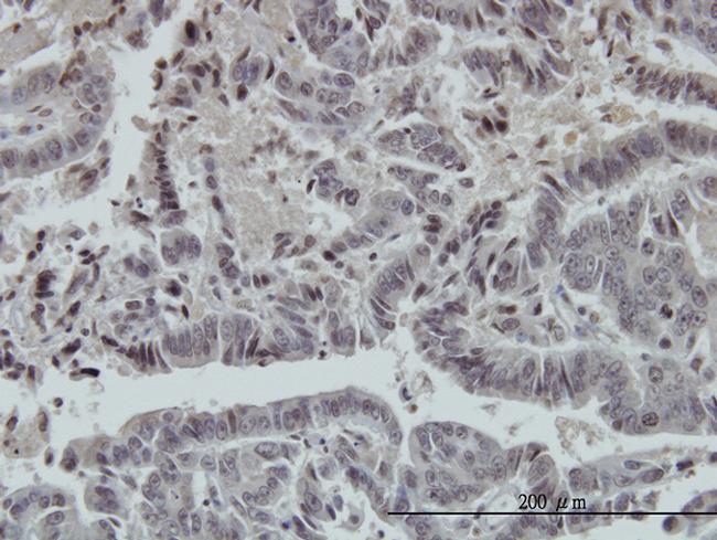 FOXO3A Antibody in Immunohistochemistry (Paraffin) (IHC (P))