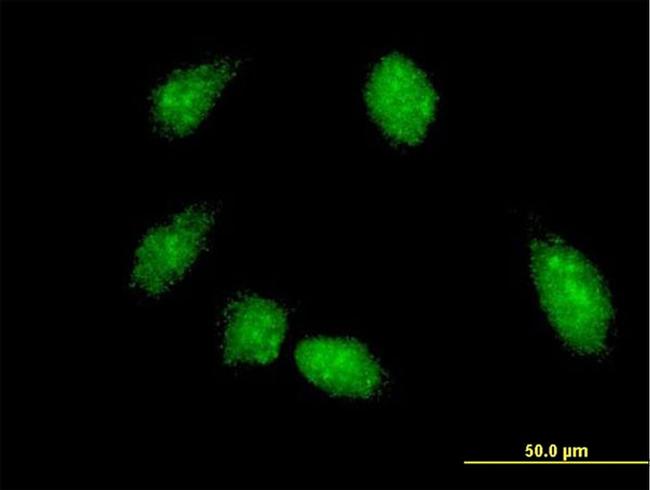 FLI1 Antibody in Immunocytochemistry (ICC/IF)