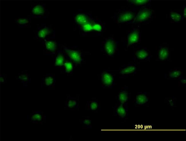 FLI1 Antibody in Immunocytochemistry (ICC/IF)