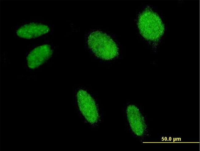 FLI1 Antibody in Immunocytochemistry (ICC/IF)