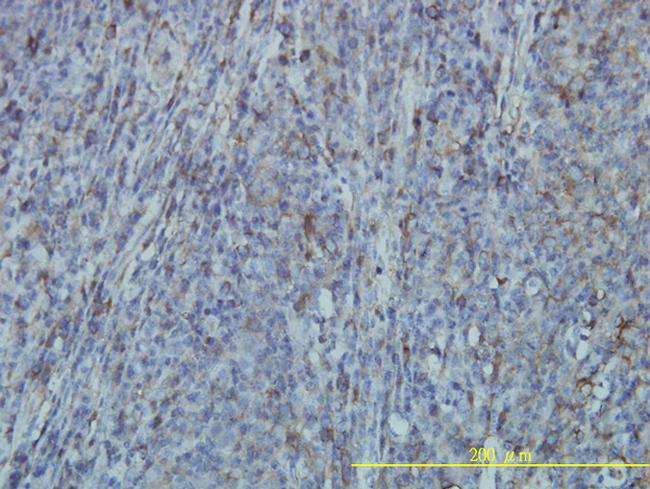 FLNA Antibody in Immunohistochemistry (Paraffin) (IHC (P))