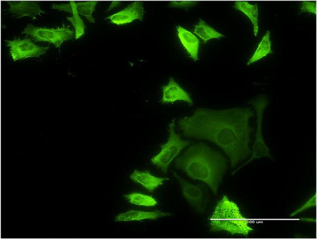 FLNA Antibody in Immunocytochemistry (ICC/IF)