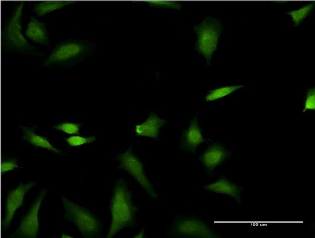 FNTB Antibody in Immunocytochemistry (ICC/IF)