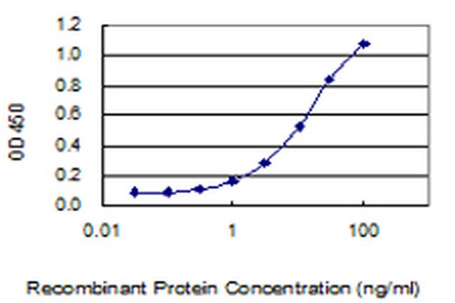 FOLH1 Antibody in ELISA (ELISA)