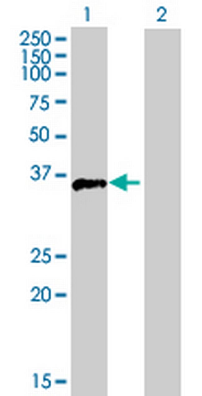 FOSB Antibody in Western Blot (WB)