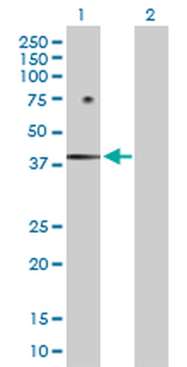 FOSB Antibody in Western Blot (WB)