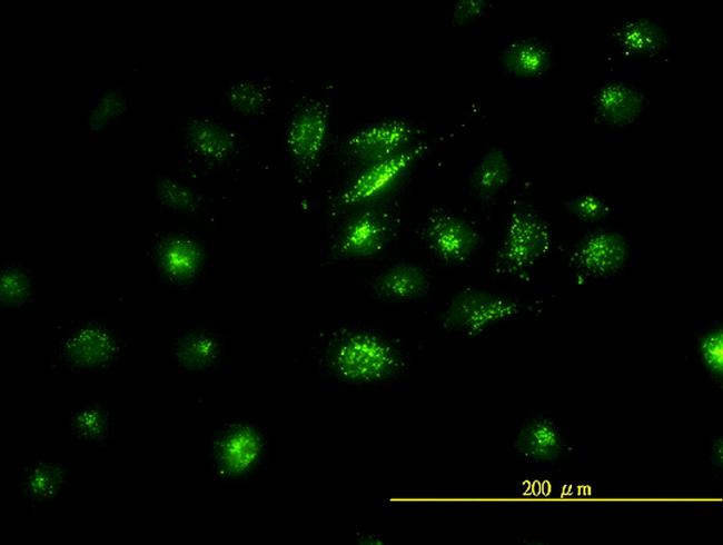 FOSL2 Antibody in Immunocytochemistry (ICC/IF)