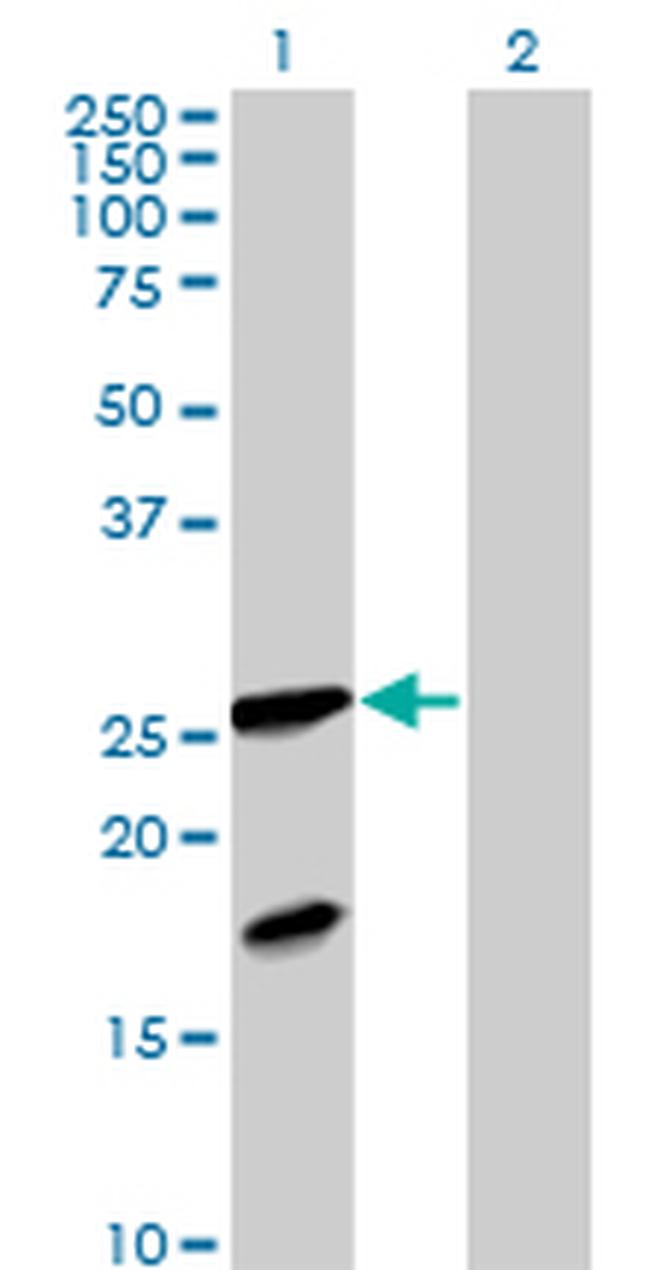 FXN Antibody in Western Blot (WB)