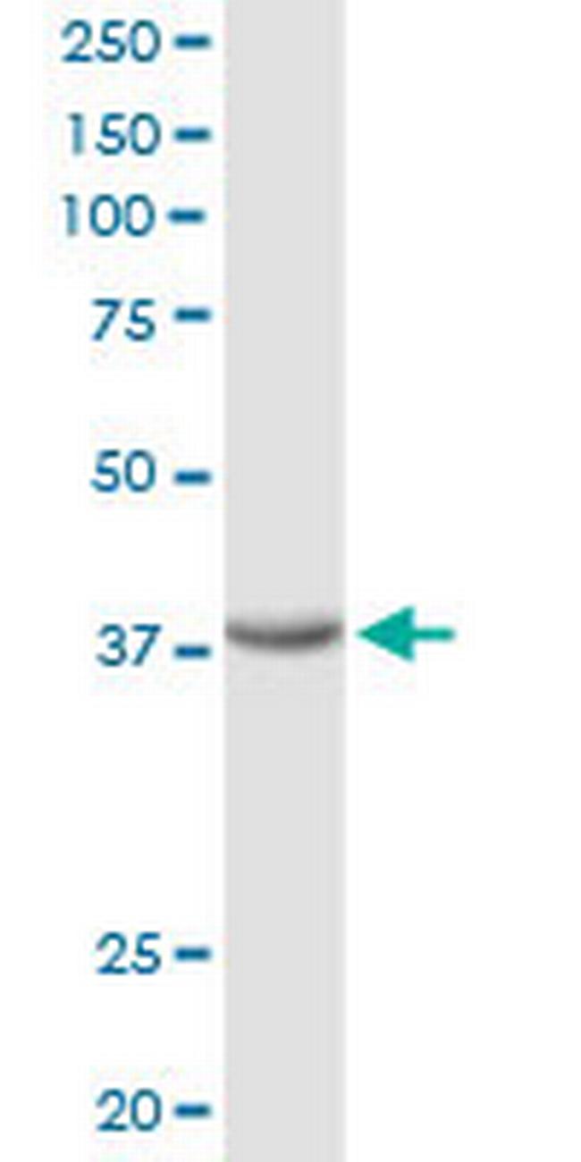 FRZB Antibody in Western Blot (WB)