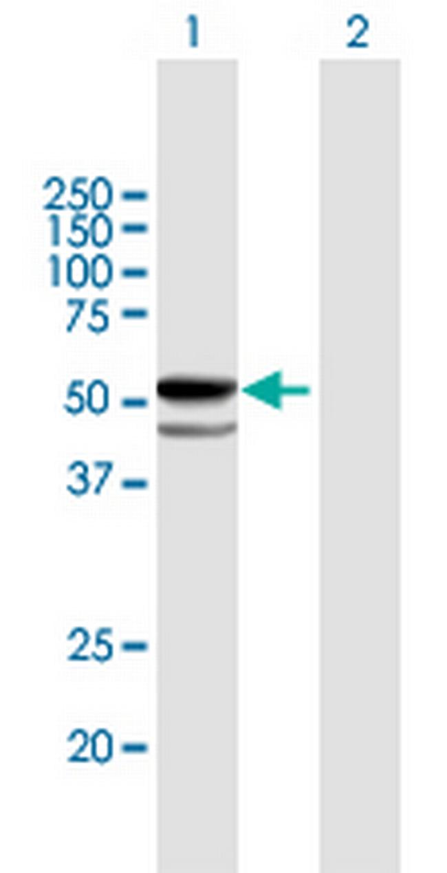 FUCA1 Antibody in Western Blot (WB)