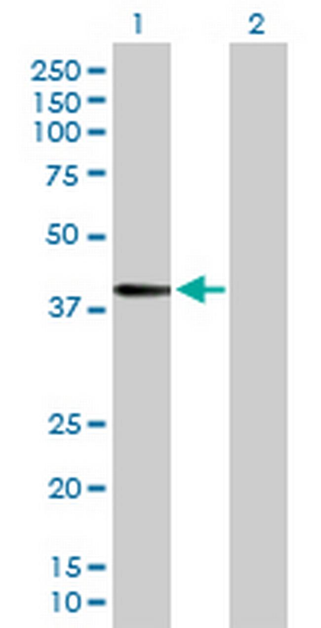 FUT3 Antibody in Western Blot (WB)