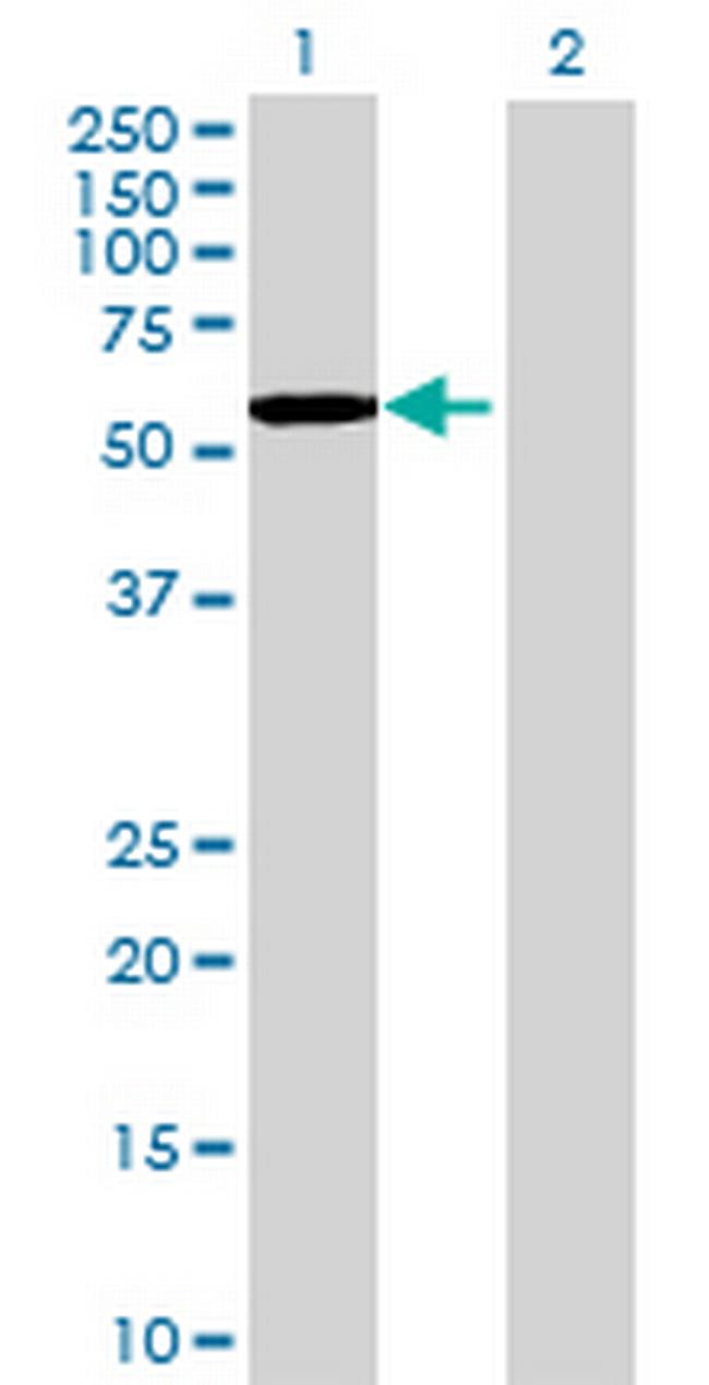 FYN Antibody in Western Blot (WB)