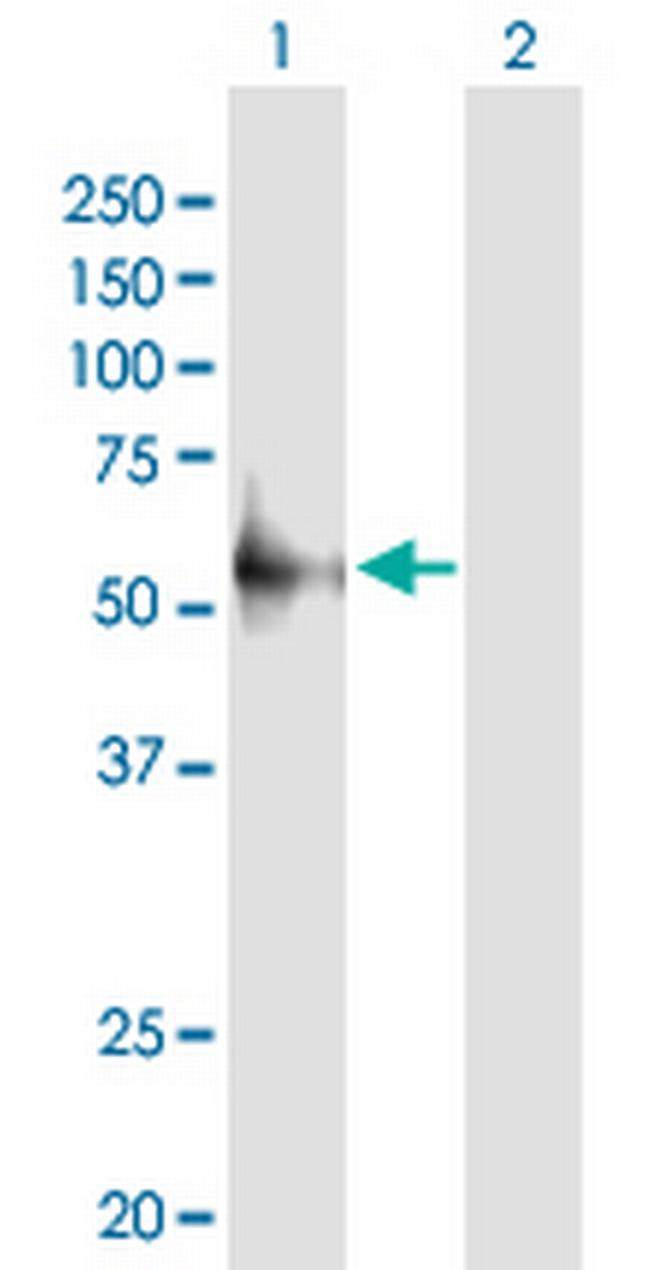 FYN Antibody in Western Blot (WB)