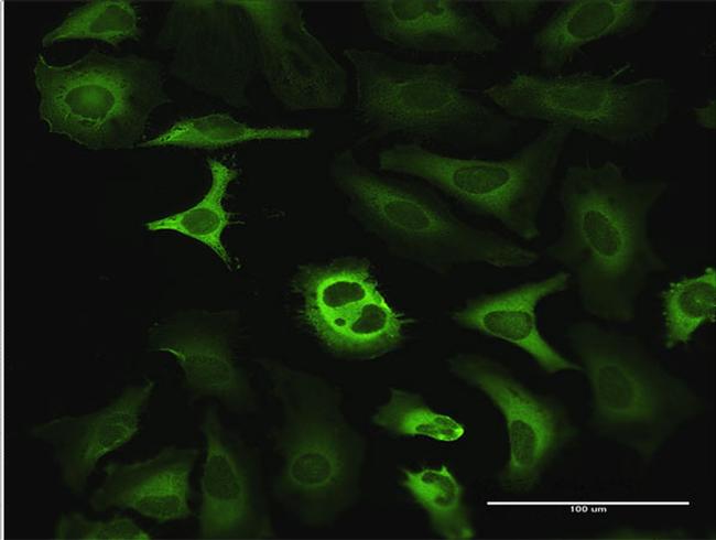 G6PD Antibody in Immunocytochemistry (ICC/IF)